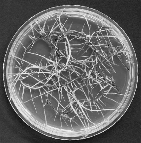 Hairy Root Culture Obtained By Agrobacteriummediated Transformation Of