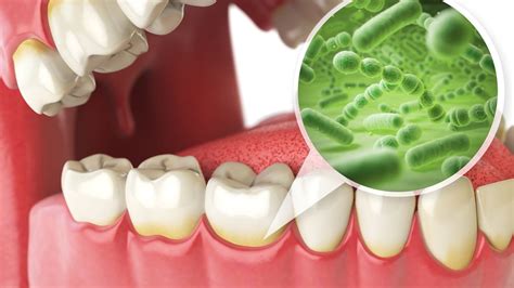 Balancing Your Mouths Microbiome Valley Dental Care