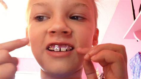 How To Make Fake Braces For Kids