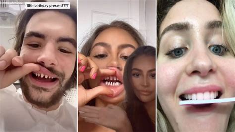 Tiktok Teeth Shaving Video Gallery Sorted By Score List View