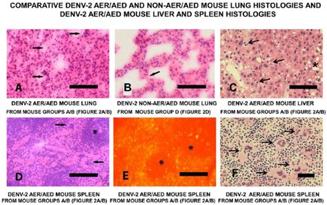 Comparative Denv 2 Aeraed And Non Aeraed Mouse Lung Histologies And