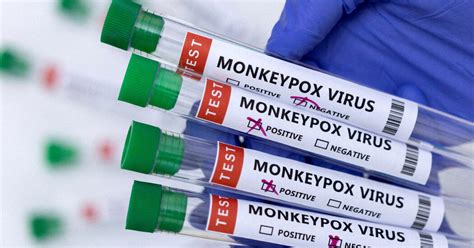 Monkeypox Virus Your Risk Explained The New York Times
