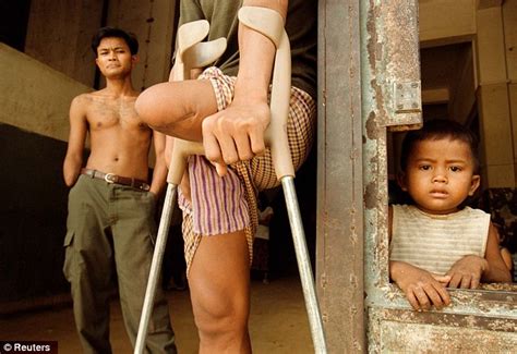 One Legged Husband Devastated After His Wife Who Lost Both Her Legs In