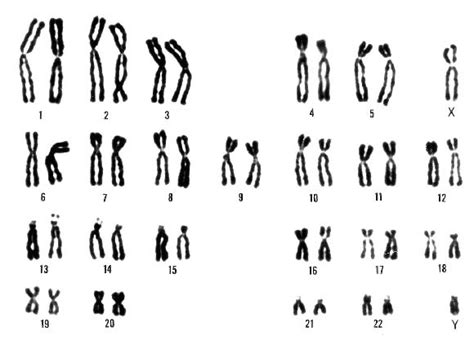 Chromosomes Human Pair 20 Chromosome 20