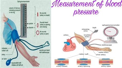 Measurement Of Blood Pressure In Cardiovascular Physiology For Medical