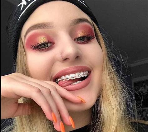 Pin By Ty0official♥️ On Brace Face Braces Girls Teeth Braces Dental Braces