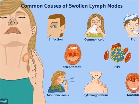 How To Reduce Swelling Of The Lymph Nodes Rivermap