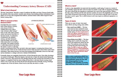 Heart Attack Angioplasty And Stent An Educational Guide For Patients