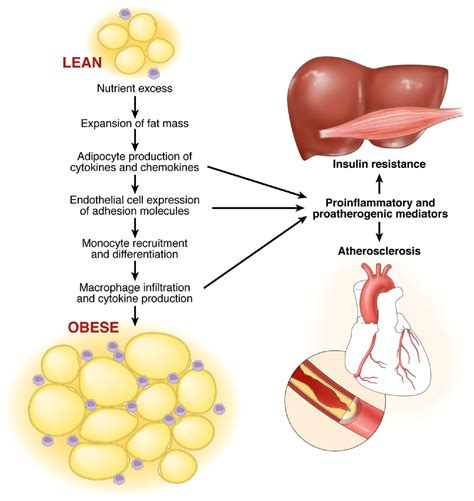 Obesity Inflammation And Insulin Resistance Gastroenterology