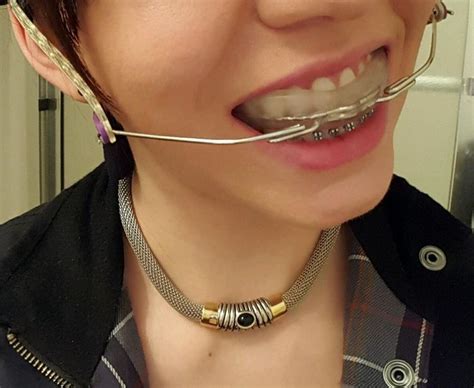 Braces Girlswithbraces Metalbraces Headgear Braces Girls Dental Braces Perfect Teeth