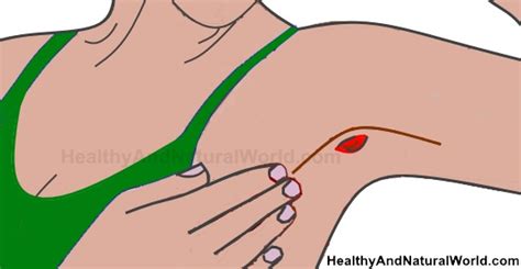 Home Remes For Blocked Sweat Gland In Armpit Homemade Ftempo