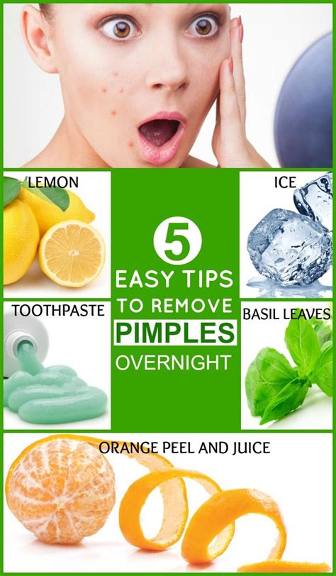 5 Easy Tips To Remove Pimples Overnight Timesfull How To Remove