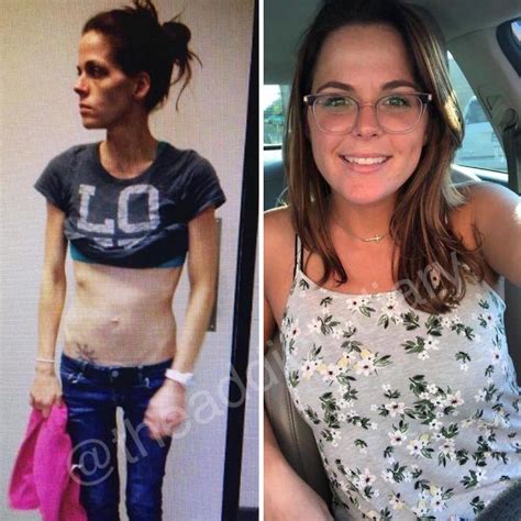 19 Incredible Before And After Transformations Stories Of
