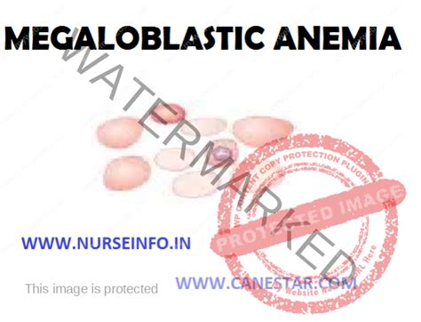 Megaloblastic Anemia Nurse Info