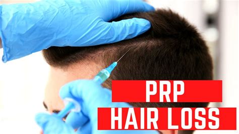 Prp Hair Restoration In Chicago For Hair Loss Youtube