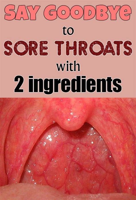 Allergies And Sore Throat One Side Swollen Tonsils Throat Severe Sore