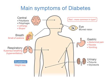 Signs And Symptoms Of Type 1 Or Type 2 Diabetes In Men And Women