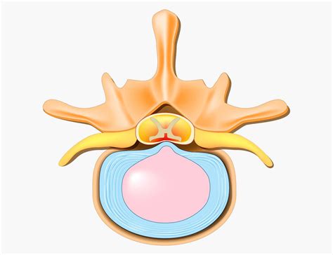 The Difference Between Bulging Disc And Herniated Disc