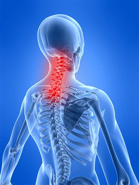 Neck Pain And Chiropractic Care Kuty Chiropractic
