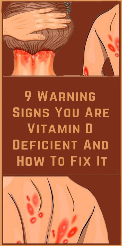 8 signs that you may have deficiency in vitamin d and how to get more health knowledge herbal