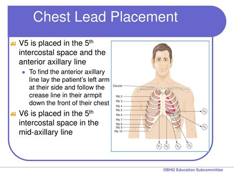 Ppt Chapter 7 For 12 Lead Training Acquisition Powerpoint