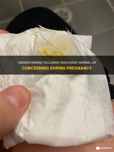 Understanding Yellowish Discharge Normal Or Concerning During