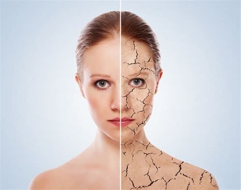 Dry Skin Patches What Is Your Skin Trying To Tell You