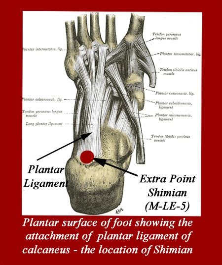 The signature symptom of plantar fasciitis is sharp pain at the heel that is present when you first get up in the. Shimian Extra Point M-LE-5 use to relieve plantar ...