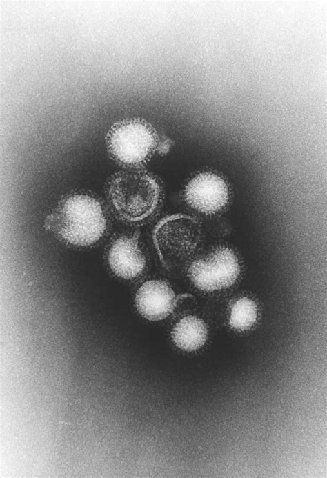 Microbe Sems Biology Of Human World Of Viruses
