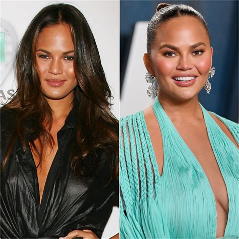 Chrissy Teigen Before And After Did The Model Get Plastic Surgery