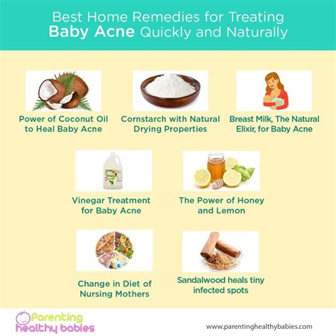 Ultimate Guide For Treating Baby Acne Naturally Home Remedies With