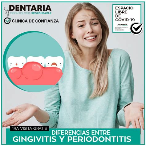 Diferencias Entre Gingivitis Y Periodontitis Soy Dentaria