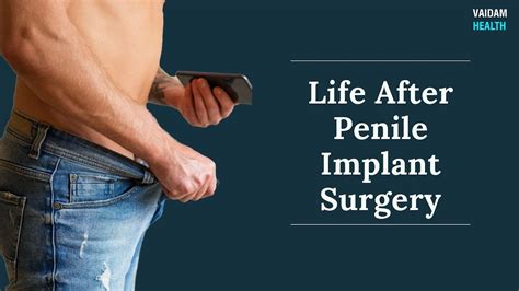 Life After Penile Implant Surgery Youtube