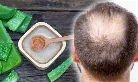 Hair Loss Treatment Aloe Vera Provides Nutrition For Hair Follicles To