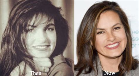 Mariska Hargitay Plastic Surgery Before And After Photos Latest Plastic Surgery Gossip And