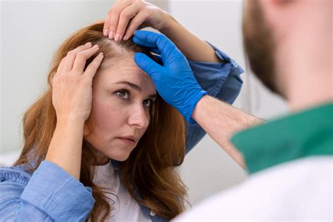 Alopecia Areata Causes Symptoms And Treatment Bodycraft