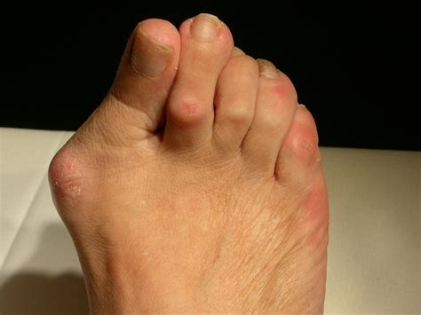 Фото большого пальца на ноге
