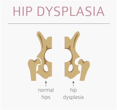A Vets Guide To Hip Dysplasia In Dogs Barkercise