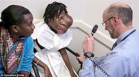 haitian teen has four pound tumor removed from her face