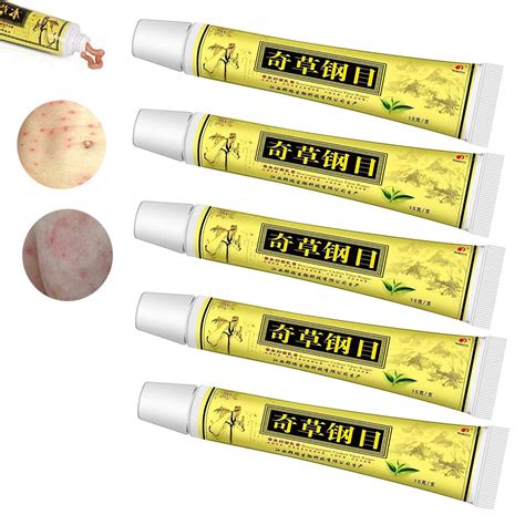 Buy Natural Chinese Herbal Cream Chines Medicine Cream Anti Itch Cream