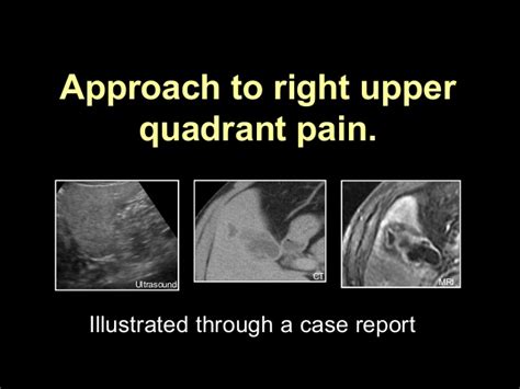 Approach To Right Upper Quadrant Pain Lessons From A Case