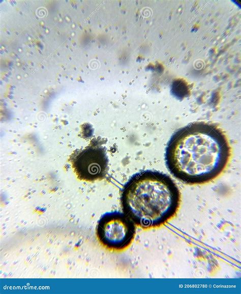 Aspergillus Niger The Black Mold Conidia Under The Microscope Stock