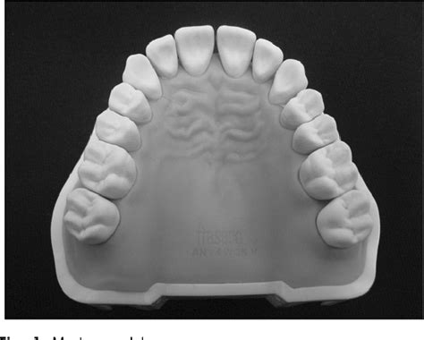 Figure 1 From Reliability And Accuracy Of Digital Impression Obtained