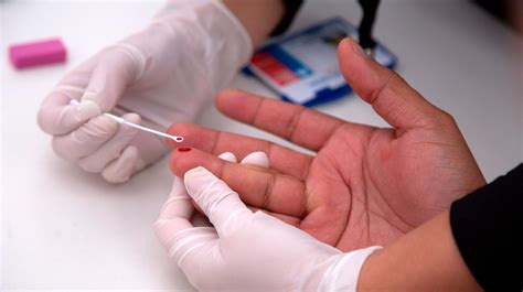 I Treated Hivaids Were Still Making The Same Mistake Now With Stds