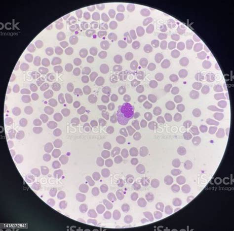 Monocyte White Blood Cells On Center Stock Photo Download Image Now
