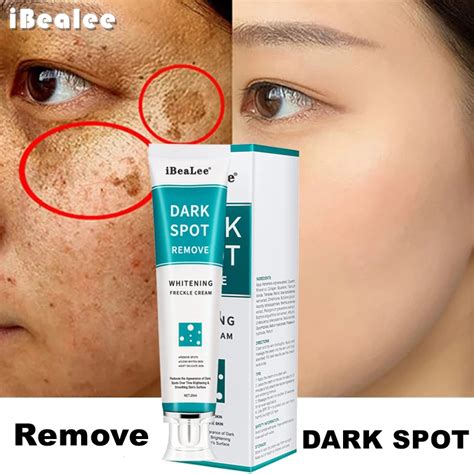 Ibealee Whitening Freckle Cream Remove Melasma Cream Remove Dark Spots Melanin Melasma Remover