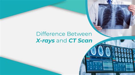 Difference Between X Rays And Ct Scans Dr Remedies Labs