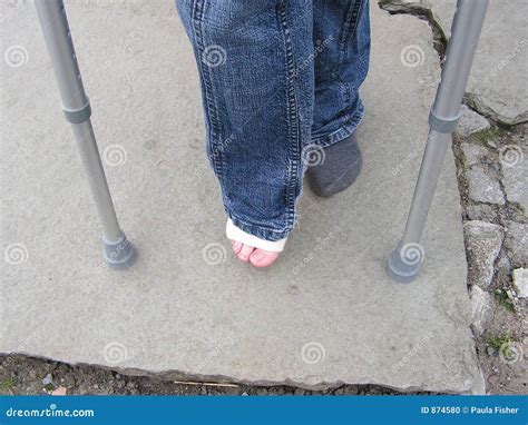 Sprained Ankle And Crutches Stock Photography 874580