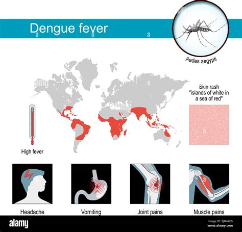 Dengue Fever Symptoms Infographics And Awareness Poster Maps Of