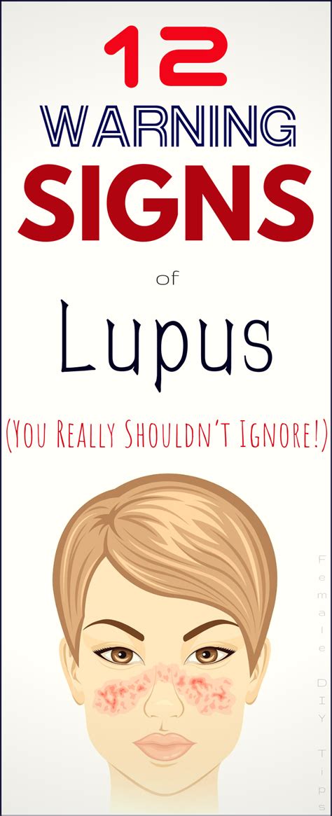 12 Warning Signs Of Lupus You Really Shouldn T Ignore Health And